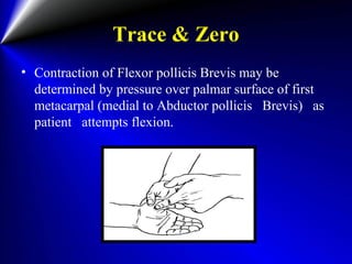 Trace & Zero
• Contraction of Flexor pollicis Brevis may be
determined by pressure over palmar surface of first
metacarpal (medial to Abductor pollicis Brevis) as
patient attempts flexion.
 
