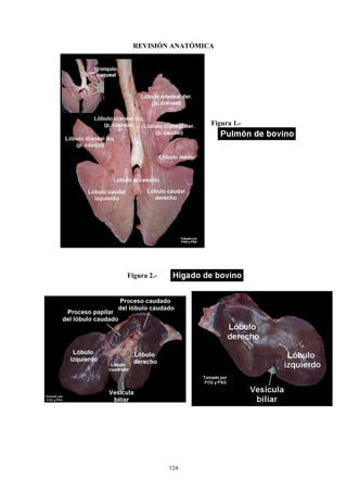 REVISIÓN ANATÓMICA




                   Figura 1.-




                                Tomado por
                                FOG y PSG




                                             Tomado por
                                             FOG y PSG




Figura 2.-




             124
 