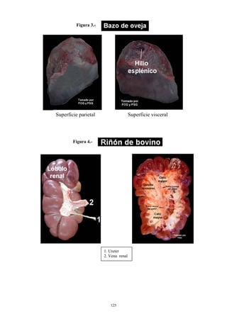 Figura 3.-




Superficie parietal                   Superficie visceral




        Figura 4.-




                      1. Ureter
                      2. Vena renal




                         125
 