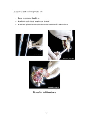 Los objetivos de la incisión primaria son:


   •   Poner en posición al cadáver.
   •   Revisar la posición de las vísceras “in situ”.
   •   Revisar la presencia de líquido o adherencias en la cavidad celómica.




                            Figuras 24.- Incisión primaria




                                             182
 