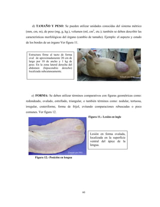 d) TAMAÑO Y PESO: Se pueden utilizar unidades conocidas del sistema métrico
(mm, cm, m), de peso (mg, g, kg.), volumen (ml, cm3, etc.); también se deben describir las
características morfológicas del órgano (cambio de tamaño). Ejemplo: el aspecto y estado
de los bordes de un órgano Ver figura 11.


  Estructura firme al tacto de forma
  oval de aproximadamente 20 cm de
  largo por 10 de ancho y 1 kg de
  peso. En la zona lateral derecha del
  abdomen (hipocondrio derecho)
  localizada subcutaneamente.
                                                                             Tomado por BMC




    e) FORMA: Se deben utilizar términos comparativos con figuras geométricas como:
redondeado, ovalado, estrellado, triangular, o también términos como: nodular, tortuosa,
irregular, crateriforme, forma de frijol, evitando comparaciones rebuscadas o poco
comunes. Ver figura 12.
                                                    Figura 11.- Lesión en ingle




                                                     Lesión en forma ovalada,
                                                     localizada en la superficie
                                                     ventral del ápice de la
                                                     lengua.

                                  Tomado por PSG

       Figura 12.- Posición en lengua




                                               60
 