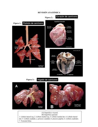 REVISIÓN ANATÓMICA

                                           Figura 2.-


Figura 1.-




                 Figura 3.-




                                        (A) Superficie visceral.
                                        (B) Superficie parietal.
       1. Lóbulo lateral izq; 2. Lóbulo medial izq; 3. Lóbulo medial der; 4. Lóbulo lateral
       der; 5. Lóbulo caudado; a. proceso caudado; b. proceso papilar; 6. Lóbulo cuadrado;
       7. Vesícula biliar.                       90
 