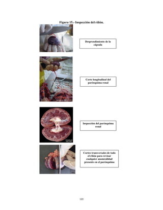Figura 15.- Inspección del riñón.




                     Desprendimiento de la
                           cápsula




                     Corte longitudinal del
                      parénquima renal




                 Inspección del parénquima
                           renal




                 Cortes transversales de todo
                     el riñón para revisar
                   cualquier anomralidad
                  presente en el parénquima




               105
 