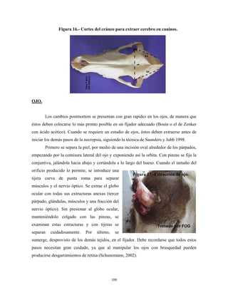 Figura 16.- Cortes del cráneo para extraer cerebro en caninos.




OJO.


       Los cambios postmortem se presentan con gran rapidez en los ojos, de manera que
éstos deben colocarse lo más pronto posible en un fijador adecuado (Bouin o el de Zenker
con ácido acético). Cuando se requiere un estudio de ojos, éstos deben extraerse antes de
iniciar los demás pasos de la necropsia, siguiendo la técnica de Saunders y Jubb 1998.
       Primero se separa la piel, por medio de una incisión oval alrededor de los párpados,
empezando por la comisura lateral del ojo y exponiendo así la orbita. Con pinzas se fija la
conjuntiva, jalándola hacia abajo y cortándola a lo largo del hueso. Cuando el tamaño del
orificio producido lo permite, se introduce una
                                                        Figura 17.-Extracción de ojo.
tijera curva de punta roma para separar
músculos y el nervio óptico. Se extrae el globo
ocular con todas sus extructuras anexas (tercer
párpado, glándulas, músculos y una fracción del
nervio óptico). Sin presionar al globo ocular,
manteniéndolo colgado con las pinzas, se
examinan estas estructuras y con tijeras se
separan   cuidadosamente.     Por   último,     se
sumerge, desprovisto de los demás tejidos, en el fijador. Debe recordarse que todos estos
pasos necesitan gran cuidado, ya que al manipular los ojos con brusquedad pueden
producirse desgarramientos de retina (Schunemann, 2002).




                                              109
 