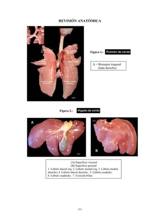 REVISIÓN ANATÓMICA




                                    Figura 1.-


                                      A = Bronquio traqueal
                                          (lado derecho)




          Figura 2.-




                     (A) Superficie visceral
                     (B) Superficie parietal
1. Lóbulo lateral izq; 2. Lóbulo medial izq; 3. Lóbulo medial
derecho; 4. Lóbulo lateral derecho; 5. Lóbulo caudado;
6. Lóbulo cuadrado; 7. Vesícula biliar.




                          111
 
