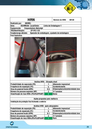 29
HRN
Realizado por: (NOME)
Data: DD/MM/AA Local/Setor: Linha de Embalagem 1
Equipamento: Empacotadora Abdcefgh
TAG/Identificação:
Função/cargo afetado:
CP-XYZ-123
Operador de embalagem, ajudante de embalagem
Foto Ilustrativa
Análise HRN - Situação atual
Probabilidade de exposição (PE)
Frequência de exposição (FE)
Grau de possível lesão (DPH)
Número de pessoas expostas (NP)
Classificação do risco HRN= (PExFExDPHxNP)
1
5
0,5
2
5
Altamente improvável
Constantemente
Dilaceração/corte/enfermidade leve
3-7 pessoas
Baixo
Ações propostas para melhoria
Instalação de proteção fixa fechando a esteira
Análise HRN - após adequações
Probabilidade de exposição (PE)
Frequência de exposição (FE)
Grau de possível lesão (DPH)
Número de pessoas expostas (NP)
Classificação do risco HRN=(PExFExDPHxNP)
Altamente improvável
Constantemente
Dilaceração/corte/enfermidade leve
3-7 pessoas
Raro
Número da HRN: 00128
1
5
0,1
2
1
NO RMA DE SEGUR ANÇA
NR-12
NORMA
REGULAMENTADORA
 