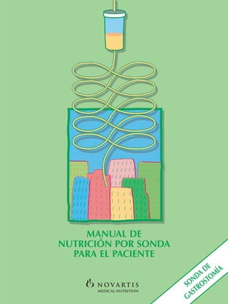 1
MANUAL DE
NUTRICIÓN POR SONDA
PARA EL PACIENTE
SONDA
DE
GASTROSTOMÍA
 