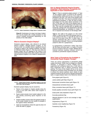 Siberet Ridge Defect Manual of clinical periodontics | PDF