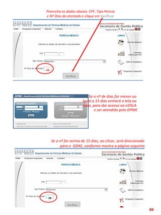 Preencha os dados abaixo: CPF, Tipo Pericia
e Nº Dias do atestado e clique em Verificar
Se o nº for acima de 15 dias, ao clicar, será direcionado
para o GDAE, conforme mostra a página seguinte.
15
Verificar
16
Verificar
15
Se o nº de dias for menor ou
Igual a 15 dias entrará a tela ao
lado, para dar acesso ao eSISLA
e ser atendido pelo DPME
04
 