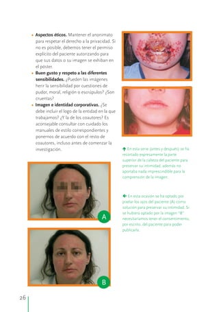 •
•
•
Aspectos éticos.
Buen gusto y respeto a las diferentes
sensibilidades.
Imagen e identidad corporativas.
Mantener el anonimato
para respetar el derecho a la privacidad. Si
no es posible, debemos tener el permiso
explícito del paciente autorizando para
que sus datos o su imagen se exhiban en
el póster.
¿Pueden las imágenes
herir la sensibilidad por cuestiones de
pudor, moral, religión o escrúpulos? ¿Son
cruentas?
¿Se
debe incluir el logo de la entidad en la que
trabajamos? ¿Y la de los coautores? Es
aconsejable consultar con cuidado los
manuales de estilo correspondientes y
ponernos de acuerdo con el resto de
coautores, incluso antes de comenzar la
investigación. éEn esta serie (antes y después) se ha
recortado expresamente la parte
superior de la cabeza del paciente para
preservar su intimidad, además no
aportaba nada imprescindible para la
comprensión de la imagen.
çEn esta ocasión se ha optado por
pixelar los ojos del paciente (A) como
solución para preservar su intimidad. Si
se hubiera optado por la imagen “B”
necesitaríamos tener el consentimiento,
por escrito, del paciente para poder
publicarla.
B
A
B
26
 