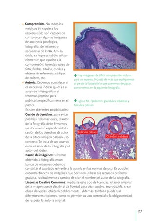 •
•
Comprensión.
Autoría.
No todos los
médicos (ni siquiera los
especialistas) son capaces de
comprender algunas imágenes
de anatomía patológica,
fotografías de lesiones o
secuencias de DNA. Ante la
duda, es imprescindible utilizar
elementos que ayuden a la
comprensión: leyendas y pies de
foto, flechas, títulos, escalas y
objetos de referencia, códigos
de colores, etc.
Debemos considerar si
es necesario indicar quién es el
autor de la fotografía y si
tenemos permiso para
publicarla específicamente en el
póster.
Existen diferentes posibilidades:
éHay imágenes de difícil comprensión incluso
para un experto. No está de más que expliquemos
al pie de la fotografía lo que queremos destacar,
como vemos en la siguiente fotografía.
êFigura XX. Epidermis: glándulas sebáceas y
folículos pilosos
Folículo piloso
Glándula sebácea
Cesión de derechos: para evitar
posibles reclamaciones, el autor
de la fotografía debe firmarnos
un documento especificando la
cesión de los derechos de autor
de la citada imagen para un uso
concreto. Se trata de un acuerdo
entre el autor de la fotografía y el
autor del póster.
Banco de imágenes: si hemos
obtenido la fotografía en un
banco de imágenes debemos
consultar el apartado referente a la autoría en las normas de uso. Es posible
encontrar bancos de imágenes que permiten utilizar sus recursos de forma
gratuita, habitualmente a cambio de citar el nombre del autor de la fotografía.
Licencias Creative Commons: mediante este tipo de licencias, el autor original
de la imagen puede decidir si da libertad para citar su obra, reproducirla, crear
obras derivadas, ofrecerla públicamente... Además, también puede fijar
diferentes restricciones, como no permitir su uso comercial o la obligatoriedad
de respetar la autoría original.
27
 