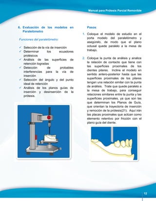 Manual para Prótesis Parcial Removible
12
6. Evaluación de los modelos en
Paralelómetro
Funciones del paralelómetro:
 Selección de la vía de inserción
 Determinar los ecuadores
protésicos
 Análisis de las superficies de
retención logradas
 Detección de probables
interferencias para la vía de
inserción
 Selección del ángulo y del punto
ideal de retención
 Análisis de los planos guías de
inserción y desinserción de la
prótesis.
Pasos:
1. Coloque el modelo de estudio en el
porta modelo del paralelómetro y
asegúrelo, de modo que el plano
oclusal quede paralelo a la mesa de
trabajo.
2. Coloque la punta de análisis y analice
la relación de contacto que tiene con
las superficies proximales de los
dientes pilares. Incline el modelo en
sentido antero-posterior hasta que las
superficies proximales de los pilares
tengan una relación similar con la punta
de análisis. Trate que quede paralelo a
la mesa de trabajo, para conseguir
relaciones similares entre la punta y las
superficies proximales, ya que son las
que determinan los Planos de Guía,
que orientan la trayectoria de inserción
y remoción de la prótesis(21). Aquí irán
las placas proximales que actúan como
elemento retentivo por fricción con el
plano guía del diente.
 