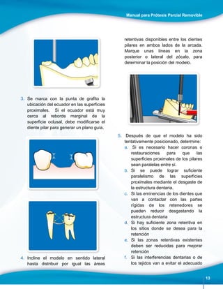 Manual para Prótesis Parcial Removible
13
3. Se marca con la punta de grafito la
ubicación del ecuador en las superficies
proximales. Si el ecuador está muy
cerca al reborde marginal de la
superficie oclusal, debe modificarse el
diente pilar para generar un plano guía.
4. Incline el modelo en sentido lateral
hasta distribuir por igual las áreas
retentivas disponibles entre los dientes
pilares en ambos lados de la arcada.
Marque unas líneas en la zona
posterior o lateral del zócalo, para
determinar la posición del modelo.
5. Después de que el modelo ha sido
tentativamente posicionado, determine:
a. Si es necesario hacer coronas o
restauraciones para que las
superficies proximales de los pilares
sean paralelas entre sí.
b. Si se puede lograr suficiente
paralelismo de las superficies
proximales mediante el desgaste de
la estructura dentaria.
c. Si las eminencias de los dientes que
van a contactar con las partes
rígidas de los retenedores se
pueden reducir desgastando la
estructura dentaria
d. Si hay suficiente zona retentiva en
los sitios donde se desea para la
retención
e. Si las zonas retentivas existentes
deben ser reducidas para mejorar
retención
f. Si las interferencias dentarias o de
los tejidos van a evitar el adecuado
 