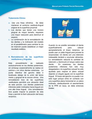 Manual para Prótesis Parcial Removible
17
Tratamiento Clínico
a. Use una fresa cilíndrica. Se debe
mantener el contorno vestíbulo-lingual
original de la superficie proximal
b. Los dientes que tienen una tronera
gingival de mayor tamaño, requieren
una mayor reducción para disminuir el
espacio
c. La combinación de la remodelación de
los dientes y la inclinación del modelo
en el paralelómetro para cambiar la vía
de inserción puede establecer un mejor
resultado estético.
4. Remodelación de las superficies
vestibulares y linguales
Este procedimiento es realizado
exclusivamente en los dientes posteriores,
sin embargo ocasionalmente se realiza en
caninos y en otros dientes anteriores. La
punta retentiva del gancho debe ir
localizada debajo de la unión del tercio
medio y gingival de la corona clínica. Una
remodelación leve de las superficies
vestibulares permitirá una ubicación ideal
de esta porción. Los dientes posteriores
inferiores están inclinados hacia lingual con
una alta línea lingual. Una remodelación
leve puede mejorar la posición de esta
línea y permitir la fácil colocación del brazo
recíproco.
Cuando no es posible remodelar el diente
superficialmente para colocar
apropiadamente el brazo reciproco, se
puede usar un plato lingual para proveer la
reciprocidad. Un diente con una retención
indeseable tenderá a acumular alimentos.
La remodelación reducirá la cantidad de
retención y disminuirá el torque sobre ese
diente. En ocasiones, los dientes
posteriores inferiores han sido muy
desgastados o la superficie oclusal ha sido
ajustada para mejorar el plano oclusal
dejando un ángulo agudo con la superficie
lingual. El brazo del gancho no puede ir en
este lugar porque entra en contacto con
una superficie plana horizontal en un plano
inclinado, obstaculizando el asentamiento
de la PPR en boca, se debe entonces
biselar.
 