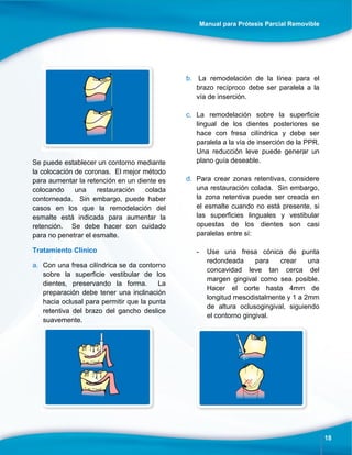Manual para Prótesis Parcial Removible
18
Se puede establecer un contorno mediante
la colocación de coronas. El mejor método
para aumentar la retención en un diente es
colocando una restauración colada
contorneada. Sin embargo, puede haber
casos en los que la remodelación del
esmalte está indicada para aumentar la
retención. Se debe hacer con cuidado
para no penetrar el esmalte.
Tratamiento Clínico
a. Con una fresa cilíndrica se da contorno
sobre la superficie vestibular de los
dientes, preservando la forma. La
preparación debe tener una inclinación
hacia oclusal para permitir que la punta
retentiva del brazo del gancho deslice
suavemente.
b. La remodelación de la línea para el
brazo recíproco debe ser paralela a la
vía de inserción.
c. La remodelación sobre la superficie
lingual de los dientes posteriores se
hace con fresa cilíndrica y debe ser
paralela a la vía de inserción de la PPR.
Una reducción leve puede generar un
plano guía deseable.
d. Para crear zonas retentivas, considere
una restauración colada. Sin embargo,
la zona retentiva puede ser creada en
el esmalte cuando no está presente, si
las superficies linguales y vestibular
opuestas de los dientes son casi
paralelas entre sí:
- Use una fresa cónica de punta
redondeada para crear una
concavidad leve tan cerca del
margen gingival como sea posible.
Hacer el corte hasta 4mm de
longitud mesodistalmente y 1 a 2mm
de altura oclusogingival, siguiendo
el contorno gingival.
 