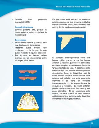 Manual para Prótesis Parcial Removible
32
- Cuando hay presencia
toruspalatino(32).
Contraindicaciones
- Bóveda palatina alta, porque la
banda palatina anterior interfiere la
fonación(27).
Desventajas
- No da buen soporte y cuando está
mal diseñada no tiene rigidez
- Presenta cuatro bordes que
contactan con la lengua, lo que
puede molestar a algunos pacientes
- Por lo cual los bordes deben
terminar en las depresiones entre
las rugas, esta forma.
En este caso, está indicado un conector
antero-posterior, ya que presenta múltiples
dientes ausentes distribuidos alrededor del
arco, y donde hay buen soporte dental.
El conector antero-posterior tiene una
buena rigidez gracias a que las barras
anterior y posterior pueden ser colocadas
en diferentes planos creando una forma de
“L” dando efecto de viga. A pesar que este
conector deja una amplia zona de paladar
descubierto, tiene la desventaja que la
barra anterior cruza la mucosa de la zona
anterior del paladar que esta ricamente
inervada y se pone en contacto
frecuentemente con la lengua durante la
deglución y fonación. La barra anterior
puede interferir con estas funciones y ser
poco tolerados. Si se selecciona este
diseño, se debe colocar la barra anterior
cuidadosamente y su forma debe llevar los
contornos de las rugas palatinas.
 