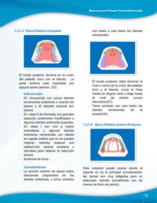 Manual para Prótesis Parcial Removible
33
1.3.1.3 Placa Palatina Completa
El borde posterior termina en la unión
del paladar duro con el blando. La
parte anterior esta soportada por
apoyos sobre caninos (33).
Indicaciones
- En situaciones con pocos dientes
remanentes anteriores o cuando los
pilares y el reborde residual son
pobres
- En clase II de Kennedy con grandes
espacios posteriores modificados y
algunos dientes anteriores ausentes
- En clase I con uno a cuatro
premolares y algunos dientes
anteriores remanentes con pilares
en regular estado que no se pueden
mejorar; reborde residual con
reabsorción vertical excesiva y
dificultad para obtener la retención
directa
- Ausencia de torus.
Características
- La porción anterior se apoya sobre
descansos preparados en los
dientes anteriores, y toma contacto
con todos o casi todos los dientes
remanentes.
- El borde posterior debe terminar al
nivel o cerca de la unión del paladar
duro y el blando, cruza la línea
media en ángulo recto y llega hasta
el nivel de ambos surcos
hamulares(27).
- Tiene contacto con casi todos los
dientes remanentes de la
arcada(34).
1.3.1.4 Barra Palatina Antero-Posterior
Este conector puede usarse donde el
soporte no es la principal consideración;
las barras son muy delgadas para un
adecuado soporte (usualmente son de
menos de 8mm de ancho).
 