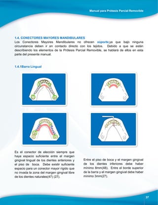 Manual para Prótesis Parcial Removible
37
1.4. CONECTORES MAYORES MANDIBULARES
Los Conectores Mayores Mandibulares no ofrecen soporte,ya que bajo ninguna
circunstancia deben ir en contacto directo con los tejidos. Debido a que se están
describiendo los elementos de la Prótesis Parcial Removible, se hablará de ellos en esta
parte del presente manual.
1.4.1Barra Lingual
Es el conector de elección siempre que
haya espacio suficiente entre el margen
gingival lingual de los dientes anteriores y
el piso de boca. Debe existir suficiente
espacio para un conector mayor rígido que
no invada la zona del margen gingival libre
de los dientes naturales(47) (27).
Entre el piso de boca y el margen gingival
de los dientes inferiores debe haber
mínimo 8mm(48). Entre el borde superior
de la barra y el margen gingival debe haber
mínimo 3mm(27).
 