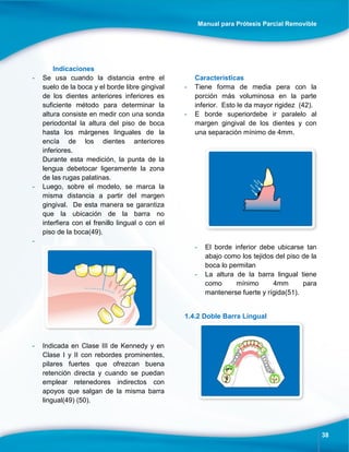 Manual para Prótesis Parcial Removible
38
Indicaciones
- Se usa cuando la distancia entre el
suelo de la boca y el borde libre gingival
de los dientes anteriores inferiores es
suficiente método para determinar la
altura consiste en medir con una sonda
periodontal la altura del piso de boca
hasta los márgenes linguales de la
encía de los dientes anteriores
inferiores.
Durante esta medición, la punta de la
lengua debetocar ligeramente la zona
de las rugas palatinas.
- Luego, sobre el modelo, se marca la
misma distancia a partir del margen
gingival. De esta manera se garantiza
que la ubicación de la barra no
interfiera con el frenillo lingual o con el
piso de la boca(49).
-
- Indicada en Clase III de Kennedy y en
Clase I y II con rebordes prominentes,
pilares fuertes que ofrezcan buena
retención directa y cuando se puedan
emplear retenedores indirectos con
apoyos que salgan de la misma barra
lingual(49) (50).
Características
- Tiene forma de media pera con la
porción más voluminosa en la parte
inferior. Esto le da mayor rigidez (42).
- E borde superiordebe ir paralelo al
margen gingival de los dientes y con
una separación mínimo de 4mm.
- El borde inferior debe ubicarse tan
abajo como los tejidos del piso de la
boca lo permitan
- La altura de la barra lingual tiene
como mínimo 4mm para
mantenerse fuerte y rígida(51).
1.4.2 Doble Barra Lingual
 