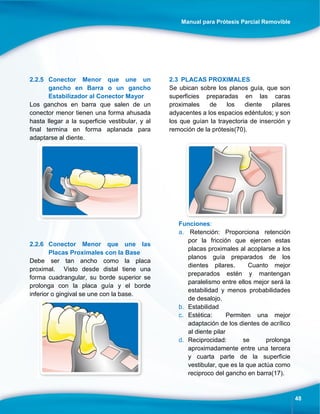 Manual para Prótesis Parcial Removible
48
2.2.5 Conector Menor que une un
gancho en Barra o un gancho
Estabilizador al Conector Mayor
Los ganchos en barra que salen de un
conector menor tienen una forma ahusada
hasta llegar a la superficie vestibular, y al
final termina en forma aplanada para
adaptarse al diente.
2.2.6 Conector Menor que une las
Placas Proximales con la Base
Debe ser tan ancho como la placa
proximal. Visto desde distal tiene una
forma cuadrangular, su borde superior se
prolonga con la placa guía y el borde
inferior o gingival se une con la base.
2.3 PLACAS PROXIMALES
Se ubican sobre los planos guía, que son
superficies preparadas en las caras
proximales de los diente pilares
adyacentes a los espacios edéntulos; y son
los que guían la trayectoria de inserción y
remoción de la prótesis(70).
Funciones:
a. Retención: Proporciona retención
por la fricción que ejercen estas
placas proximales al acoplarse a los
planos guía preparados de los
dientes pilares. Cuanto mejor
preparados estén y mantengan
paralelismo entre ellos mejor será la
estabilidad y menos probabilidades
de desalojo.
b. Estabilidad
c. Estética: Permiten una mejor
adaptación de los dientes de acrílico
al diente pilar
d. Reciprocidad: se prolonga
aproximadamente entre una tercera
y cuarta parte de la superficie
vestibular, que es la que actúa como
reciproco del gancho en barra(17).
 