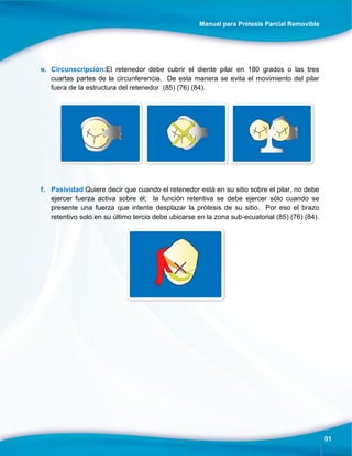 Manual para Prótesis Parcial Removible
51
e. Circunscripción:El retenedor debe cubrir el diente pilar en 180 grados o las tres
cuartas partes de la circunferencia. De esta manera se evita el movimiento del pilar
fuera de la estructura del retenedor (85) (76) (84).
f. Pasividad:Quiere decir que cuando el retenedor está en su sitio sobre el pilar, no debe
ejercer fuerza activa sobre él; la función retentiva se debe ejercer sólo cuando se
presente una fuerza que intente desplazar la prótesis de su sitio. Por eso el brazo
retentivo solo en su último tercio debe ubicarse en la zona sub-ecuatorial (85) (76) (84).
 