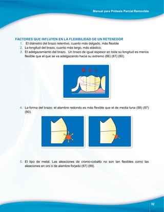 Manual para Prótesis Parcial Removible
52
FACTORES QUE INFLUYEN EN LA FLEXIBILIDAD DE UN RETENEDOR
1. El diámetro del brazo retentivo, cuanto más delgado, más flexible
2. La longitud del brazo, cuanto más largo, más elástico.
3. El adelgazamiento del brazo. Un brazo de igual espesor en toda su longitud es menos
flexible que el que se va adelgazando hacia su extremo (86) (87) (80).
4. La forma del brazo; el alambre redondo es más flexible que el de media luna (88) (87)
(80).
5. El tipo de metal. Las aleaciones de cromo-cobalto no son tan flexibles como las
aleaciones en oro o de alambre forjado (87) (89).
 