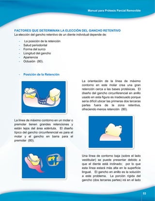 Manual para Prótesis Parcial Removible
53
FACTORES QUE DETERMINAN LA ELECCIÓN DEL GANCHO RETENTIVO
La elección del gancho retentivo de un diente individual depende de:
- La posición de la retención
- Salud periodontal
- Forma del surco
- Longitud del gancho
- Apariencia
- Oclusión (80).
- Posición de la Retención
La línea de máximo contorno en un molar o
premolar tienen grandes retenciones y
están lejos del área edéntula. El diseño
típico del gancho circunferencial es para el
molar y el gancho en barra para el
premolar (80).
La orientación de la línea de máximo
contorno en este molar crea una gran
retención cerca a las bases protésicas. El
diseño del gancho circunferencial en anillo
usado en esta figura es inadecuado porque
sería difícil ubicar las primeras dos terceras
partes fuera de la zona retentiva,
ofreciendo menos retención (80).
Una línea de contorno baja (sobre el lado
vestibular) se puede presentar debido a
que el diente está inclinado; por lo que
esta línea estará más alta en la superficie
lingual. El gancho en anillo es la solución
a este problema. La porción rígida del
gancho (dos terceras partes) irá en el lado
 