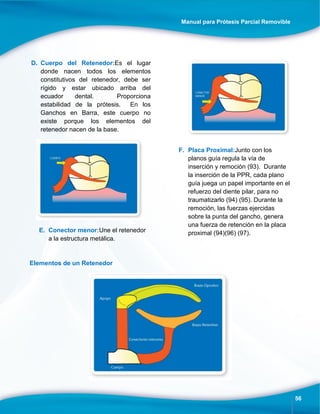 Manual para Prótesis Parcial Removible
56
D. Cuerpo del Retenedor:Es el lugar
donde nacen todos los elementos
constitutivos del retenedor, debe ser
rígido y estar ubicado arriba del
ecuador dental. Proporciona
estabilidad de la prótesis. En los
Ganchos en Barra, este cuerpo no
existe porque los elementos del
retenedor nacen de la base.
E. Conector menor:Une el retenedor
a la estructura metálica.
F. Placa Proximal:Junto con los
planos guía regula la vía de
inserción y remoción (93). Durante
la inserción de la PPR, cada plano
guía juega un papel importante en el
refuerzo del diente pilar, para no
traumatizarlo (94) (95). Durante la
remoción, las fuerzas ejercidas
sobre la punta del gancho, genera
una fuerza de retención en la placa
proximal (94)(96) (97).
Elementos de un Retenedor
 