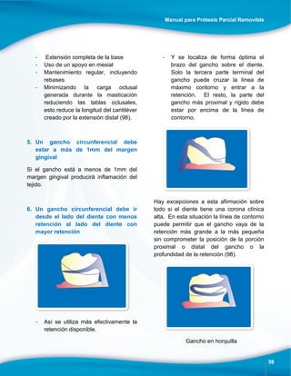 Manual para Prótesis Parcial Removible
58
- Extensión completa de la base
- Uso de un apoyo en mesial
- Mantenimiento regular, incluyendo
rebases
- Minimizando la carga oclusal
generada durante la masticación
reduciendo las tablas oclusales,
esto reduce la longitud del cantiléver
creado por la extensión distal (98).
5. Un gancho circunferencial debe
estar a más de 1mm del margen
gingival
Si el gancho está a menos de 1mm del
margen gingival producirá inflamación del
tejido.
6. Un gancho circunferencial debe ir
desde el lado del diente con menos
retención al lado del diente con
mayor retención
- Así se utiliza más efectivamente la
retención disponible.
- Y se localiza de forma óptima el
brazo del gancho sobre el diente.
Solo la tercera parte terminal del
gancho puede cruzar la línea de
máximo contorno y entrar a la
retención. El resto, la parte del
gancho más proximal y rígido debe
estar por encima de la línea de
contorno.
Hay excepciones a esta afirmación sobre
todo si el diente tiene una corona clínica
alta. En esta situación la línea de contorno
puede permitir que el gancho vaya de la
retención más grande a la más pequeña
sin comprometer la posición de la porción
proximal o distal del gancho o la
profundidad de la retención (98).
Gancho en horquilla
 