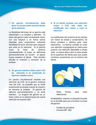Manual para Prótesis Parcial Removible
59
7. Un gancho circunferencial debe
tener su tercera parte terminal dentro
de la retención
La flexibilidad del brazo de un gancho está
relacionada a su longitud y diámetro. El
brazo del gancho esta normalmente hecho
con una longitud y en forma cónica
diseñada para proporcionar suficiente
flexibilidad al tercio terminal para asegurar
que entre en la retención. Si el gancho
cruza la línea de contorno
prematuramente, el brazo se deformará
permanentemente en función al aplicar
fuerza excesiva al diente. Esto también
dificulta la inserción y remoción de la
prótesis.
8. Un gancho retentivo debe cubrir 0.25
de retención si es construido en
aleación cobalto-cromo
Un gancho circunferencial necesita una
retención de 0.25. Si el gancho involucra
más del 0.25 es probable que su límite
proporcional se exceda cuando se inserte y
se remueva la prótesis. El gancho de
deforma permanentemente y no sería
retentivo. La longitud del gancho es un
factor crítico en la determinación de cuanta
retención se necesita (98).
9. Si un diente necesita una retención
mayor a 0.25, éste debe ser
modificado con resina y crear la
retención
La modificación del contorno de los dientes
con resina es simple y conservadora, de
forma duradera y efectiva para crear
retenciones. La técnica consiste en crear
una retención supragingival en resina para
producir una retención detectable a simple
vista. La resina debe cubrir un área amplia
de la superficie del diente para que pueda
mimetizar suavemente con el contorno del
diente.
Otras formas para crear
retenciones:
Ameloplastía, creando un pequeño hoyuelo
en el esmalte para que encuentre la punta
del gancho
- Carillas de porcelana
- Coronas MP (98).
 