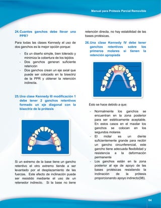 Manual para Prótesis Parcial Removible
64
24.Cuantos ganchos debe llevar una
PPR?
Para todas las clases Kennedy el uso de
dos ganchos es la mejor opción porque:
- Es un diseño simple, bien tolerado y
minimiza la cobertura de los tejidos
- Dos ganchos generan suficiente
retención
- Dos ganchos crean un eje axial que
puede ser colocado en la bisectriz
de la PPR y obtener la retención
indirecta.
25.Una clase Kennedy III modificación 1
debe tener 2 ganchos retentivos
formado un eje diagonal con la
bisectriz de la prótesis
Si un extremo de la base tiene un gancho
retentivo el otro extremo tiende a ser
levantado por el desplazamiento de las
fuerzas. Este efecto de inclinación puede
ser resistido mediante el uso de un
retenedor indirecto. Si la base no tiene
retención directa, no hay estabilidad de las
bases protésicas.
26.Una clase Kennedy IV debe tener
ganchos retentivos sobre los
primeros molares si tienen la
retención apropiada
Esto se hace debido a que:
- Normalmente los ganchos se
encuentran en la zona posterior
para ser estéticamente aceptable.
En estos casos en el maxilar los
ganchos se colocan en los
segundos molares
- El molar es un diente
suficientemente grande para recibir
un gancho circunferencial, este
gancho tiene adecuada flexibilidad y
resistencia a la deformación
permanente
- Los ganchos están en la zona
posterior al eje de apoyo de las
bases protésicas resistiendo la
inclinación de la prótesis
proporcionando apoyo indirecto(98).
 