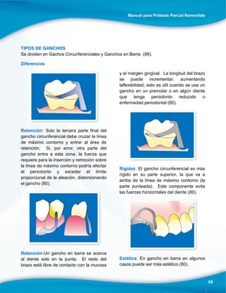 Manual para Prótesis Parcial Removible
65
TIPOS DE GANCHOS
Se dividen en Gachos Circunferenciales y Ganchos en Barra (99).
Diferencias
Retención: Solo la tercera parte final del
gancho circunferencial debe cruzar la línea
de máximo contorno y entrar al área de
retención. Si, por error, otra parte del
gancho entra a esta zona, la fuerza que
requiere para la inserción y remoción sobre
la línea de máximo contorno podría afectar
el periodonto y exceder el límite
proporcional de la aleación, distorsionando
el gancho (80).
Retención:Un gancho en barra se acerca
al diente solo en la punta. El resto del
brazo está libre de contacto con la mucosa
y el margen gingival. La longitud del brazo
se puede incrementar, aumentando
laflexibilidad, esto es útil cuando se usa un
gancho en un premolar o en algún diente
que tenga periodonto reducido o
enfermedad periodontal (80).
Rigidez: El gancho circunferencial es más
rígido en su parte superior, la que va a
arriba de la línea de máximo contorno (la
parte punteada). Este componente evita
las fuerzas horizontales del diente (80).
Estética: En gancho en barra en algunos
casos puede ser más estético (80).
 