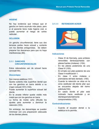 Manual para Prótesis Parcial Removible
66
HIGIENE
No hay evidencia que indique que el
gancho en barra acumule más placa, pero
si el paciente tiene mala higiene oral, si
puede aumentar el riesgo de caries
radicular.
OCLUSION
Un gancho circunferencial, tiene sus dos
terceras partes hacia oclusal y contacta
con los dientes antagonistas. Se deben
preparar los descansos para que no haya
interferencias (80).
3.1.1 GANCHOS
CIRCUNFERENCIALES
Estos retenedores van de oclusal hacia
cervical(100).
Desventajas
- Son menos estéticos (101)
- Queda cubierta más superficie dental que
con los ganchos en barra debido a su
origen oclusal (101) (102).
- Puede aumentar la superficie oclusal del
diente.
- En la arcada inferior queda visible más
metal que con los ganchos en barra
- La forma de media caña dificulta los
ajustes para aumentar o disminuir la
retención (103).
Sin embargo, las desventajas se pueden
minimizar con una preparación adecuada
de los dientes pilares.
3.1.1.1 RETENEDOR ACKER
Indicaciones
- Clase III de Kennedy, para prótesis
removibles dentosoportadas con
pilares fuertes (molares) (104).
- En los pilares posteriores de una
Clase IV (100).
- En el lado con pilar posterior de una
Clase II modificación 1.
- En clase II entre molares o
premolares del lado dentado (100).
- Cuando la retención se sitúa en la
zona vestibular del diente pilar que
se encuentra alejada del tramo
edéntulo(104).
- En casos donde el pilar está
inclinado hacia vestibular y en
dientesperiodontalmente
comprometidos (105).
Contraindicaciones
- Cuando el ecuador dental o la
estética no lo permita.
 