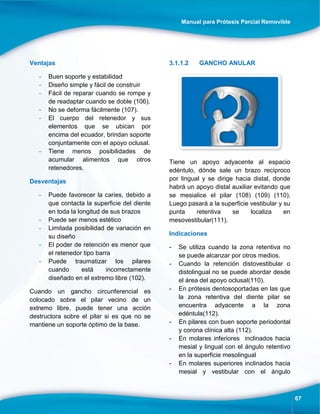 Manual para Prótesis Parcial Removible
67
Ventajas
- Buen soporte y estabilidad
- Diseño simple y fácil de construir
- Fácil de reparar cuando se rompe y
de readaptar cuando se doble (106).
- No se deforma fácilmente (107).
- El cuerpo del retenedor y sus
elementos que se ubican por
encima del ecuador, brindan soporte
conjuntamente con el apoyo oclusal.
- Tiene menos posibilidades de
acumular alimentos que otros
retenedores.
Desventajas
- Puede favorecer la caries, debido a
que contacta la superficie del diente
en toda la longitud de sus brazos
- Puede ser menos estético
- Limitada posibilidad de variación en
su diseño
- El poder de retención es menor que
el retenedor tipo barra
- Puede traumatizar los pilares
cuando está incorrectamente
diseñado en el extremo libre (102).
Cuando un gancho circunferencial es
colocado sobre el pilar vecino de un
extremo libre, puede tener una acción
destructora sobre el pilar si es que no se
mantiene un soporte óptimo de la base.
3.1.1.2 GANCHO ANULAR
Tiene un apoyo adyacente al espacio
edéntulo, dónde sale un brazo recíproco
por lingual y se dirige hacia distal, donde
habrá un apoyo distal auxiliar evitando que
se mesialice el pilar (108) (109) (110).
Luego pasará a la superficie vestibular y su
punta retentiva se localiza en
mesovestibular(111).
Indicaciones
- Se utiliza cuando la zona retentiva no
se puede alcanzar por otros medios.
- Cuando la retención distovestibular o
distolingual no se puede abordar desde
el área del apoyo oclusal(110).
- En prótesis dentosoportadas en las que
la zona retentiva del diente pilar se
encuentra adyacente a la zona
edéntula(112).
- En pilares con buen soporte periodontal
y corona clínica alta (112).
- En molares inferiores inclinados hacia
mesial y lingual con el ángulo retentivo
en la superficie mesolingual
- En molares superiores inclinados hacia
mesial y vestibular con el ángulo
 