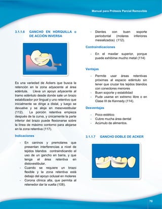 Manual para Prótesis Parcial Removible
70
3.1.1.6 GANCHO EN HORQUILLA o
DE ACCIÓN INVERSA
Es una variedad de Ackers que busca la
retención en la zona adyacente al área
edéntula. Lleva un apoyo adyacente al
tramo edéntulo desde donde sale un brazo
estabilizador por lingual y uno retentivo que
inicialmente se dirige a distal, y luego se
devuelve y se aloja en mesovestibular
(112). La porción retentiva empieza
después de la curva, y únicamente la parte
inferior del brazo puede flexionarse sobre
la línea de máximo contorno para alojarse
en la zona retentiva (117).
Indicaciones
- En caninos y premolares que
presentan interferencias a nivel de
tejidos blandos contraindicando el
uso de un gancho en barra, y que
tenga el área retentiva en
distovestibular.
- Cuando se requiere un brazo
flexible y la zona retentiva está
debajo del apoyo oclusal en molares
- Corona clínica alta, que permita al
retenedor dar la vuelta (108).
- Dientes con buen soporte
periodontal (molares inferiores
mesializados) (112).
Contraindicaciones
- En el maxilar superior, porque
puede exhibirse mucho metal (114)
Ventajas
- Permite usar áreas retentivas
próximas al espacio edéntulo sin
tener que cruzar los tejidos blandos
con conectores menores
- Buen soporte y estabilidad
- Pude usarse en extremo libre o en
Clase III de Kennedy (114).
Desventajas
- Poco estético
- Cubre mucha área dental
- Acúmulo de alimentos.
3.1.1.7 GANCHO DOBLE DE ACKER
 