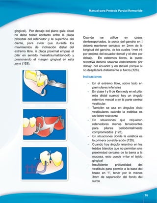 Manual para Prótesis Parcial Removible
76
gingival). Por debajo del plano guía distal
no debe haber contacto entre la placa
proximal del retenedor y la superficie del
diente, para evitar que durante los
movimientos de inclinación distal del
extremo libre, la placa proximal empuje el
pilar en sentido mesialtraumatizándolo y
presionando el margen gingival en esta
zona (128).
Cuando se utilice en casos
dentosoportados, la punta del gancho en I
deberá mantener contacto en 2mm de la
longitud del gancho, de los cuales 1mm irá
por encima del ecuador dental y el otro por
debajo. En extremos libres, la punta
retentiva deberá situarse enteramente por
debajo del ecuador y en mesial porque si
no desplazará distalmente el fulcro (126).
Indicaciones
- En el extremo libre, sobre todo en
premolares inferiores
- En clase I y II de Kennedy en el pilar
más distal cuando hay un ángulo
retentivo mesial o en la parte central
vestibular.
- También se usa en ángulos disto
vestibulares cuando la estética es
un factor relevante
- En situaciones que requieran
retenedores menos tensionantes
para pilares periodontalmente
comprometidos (128).
- En situaciones donde la estética es
la primera consideración (128).
- Cuando hay ángulo retentivo en los
tejidos blandos que no permitan una
proximidad cercana de la barra a la
mucosa, esto puede irritar el tejido
gingival
- Insuficiente profundidad del
vestíbulo para permitir a la base del
brazo en “I”, tener por lo menos
3mm de separación del fondo del
surco
 