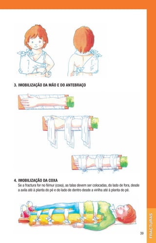 3.	 ImobIlIzação	da	mão	e	do	antebraço




4.	 ImobIlIzação	da	coxa
    Se a fractura for no fémur (coxa), as talas devem ser colocadas, do lado de fora, desde
    a axila até à planta do pé e do lado de dentro desde a virilha até à planta do pé.
                                                                                                   fracturas




                                                                                              39
 