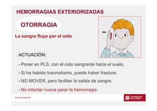 www.unirioja.es
HEMORRAGIAS EXTERIORIZADAS
OTORRAGIA
La sangre fluye por el oído
• Poner en PLS, con el oído sangrante hac...