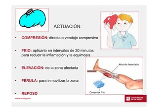 www.unirioja.es
• COMPRESIÓN: directa o vendaje compresivo
• FRIO: aplicarlo en intervalos de 20 minutos
para reducir la i...