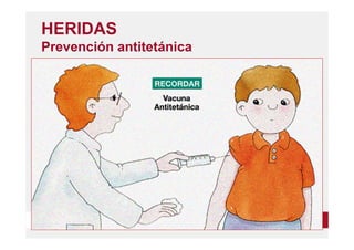 www.unirioja.es
HERIDAS
Prevención antitetánica
 