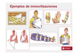 www.unirioja.es
Ejemplos de inmovilizaciones
 