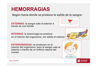 www.unirioja.es
HEMORRAGIAS
INTERNAS: la hemorragia se produce
en el interior del organismo, sin salida al exterior
EXTERI...