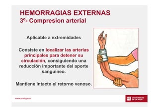 www.unirioja.es
HEMORRAGIAS EXTERNAS
3º- Compresion arterial
Aplicable a extremidades
Consiste en localizar las arterias
p...