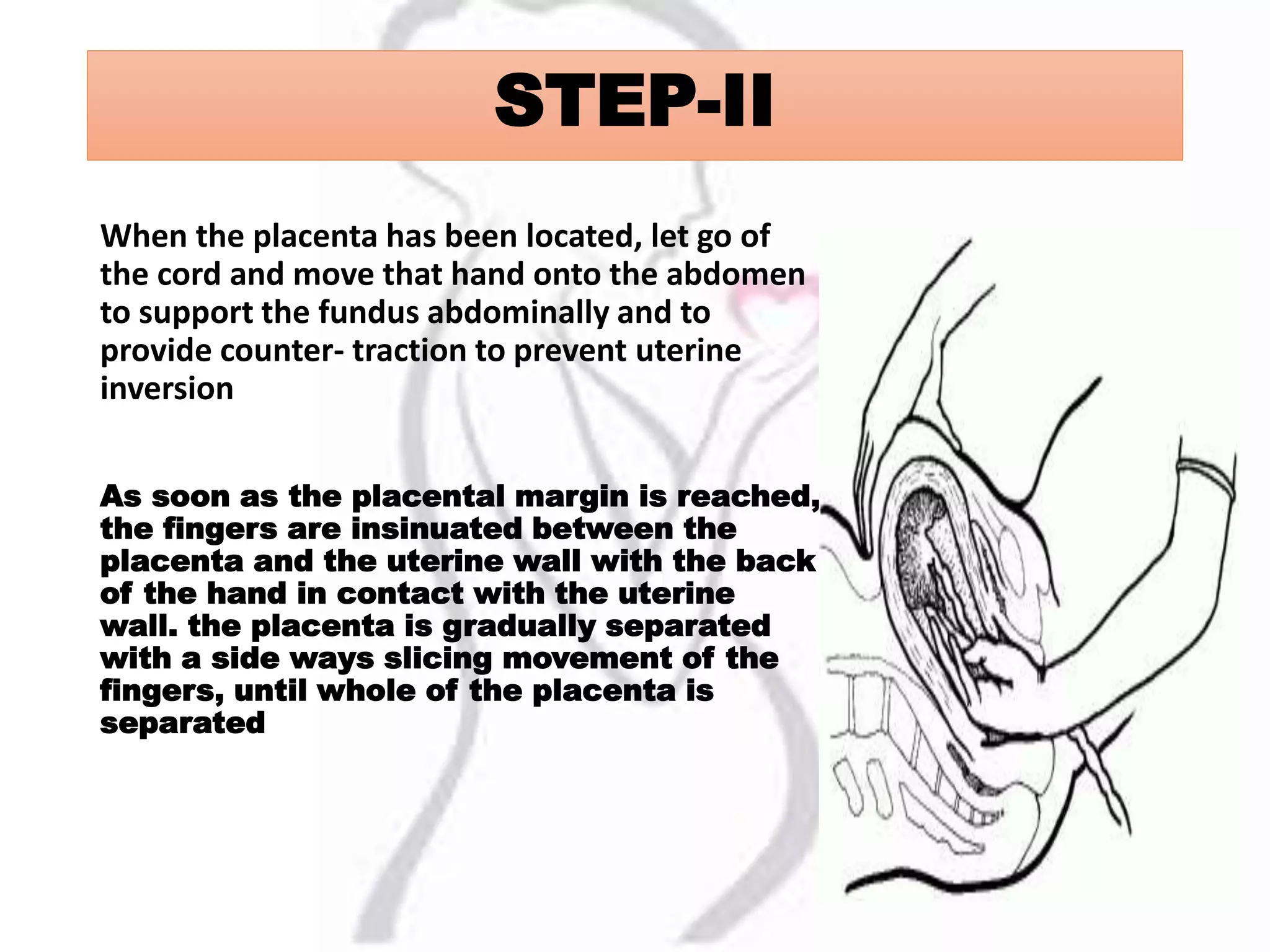 STEP-II
When the placenta has been located, let go of
the cord and move that hand onto the abdomen
to support the fundus abdominally and to
provide counter- traction to prevent uterine
inversion
As soon as the placental margin is reached,
the fingers are insinuated between the
placenta and the uterine wall with the back
of the hand in contact with the uterine
wall. the placenta is gradually separated
with a side ways slicing movement of the
fingers, until whole of the placenta is
separated
 
