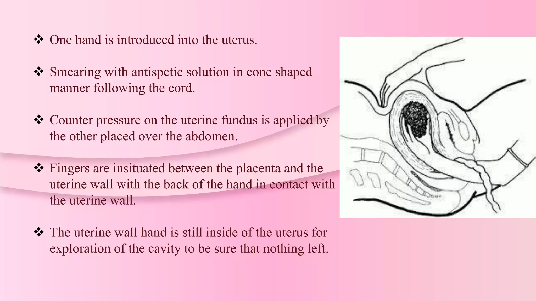  One hand is introduced into the uterus.
 Smearing with antispetic solution in cone shaped
manner following the cord.
 Counter pressure on the uterine fundus is applied by
the other placed over the abdomen.
 Fingers are insituated between the placenta and the
uterine wall with the back of the hand in contact with
the uterine wall.
 The uterine wall hand is still inside of the uterus for
exploration of the cavity to be sure that nothing left.
 