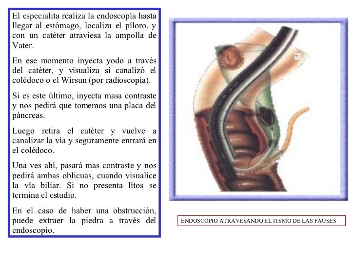 Los indicios del delirium tremens después de la dipsomanía