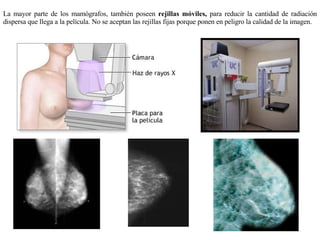 La mayor parte de los mamógrafos, también poseen  rejillas móviles,  para reducir la cantidad de radiación dispersa que llega a la película. No se aceptan las rejillas fijas porque ponen en peligro la calidad de la imagen. 