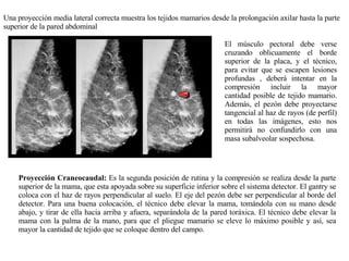 Una proyección media lateral correcta muestra los tejidos mamarios desde la prolongación axilar hasta la parte superior de la pared abdominal El músculo pectoral debe verse cruzando oblicuamente el borde superior de la placa, y el técnico, para evitar que se escapen lesiones profundas , deberá intentar en la compresión incluir la mayor cantidad posible de tejido mamario. Además, el pezón debe proyectarse tangencial al haz de rayos (de perfil) en todas las imágenes, esto nos permitirá no confundirlo con una masa subalveolar sospechosa. Proyección Craneocaudal:  Es la segunda posición de rutina y la compresión se realiza desde la parte superior de la mama, que esta apoyada sobre su superficie inferior sobre el sistema detector. El gantry se coloca con el haz de rayos perpendicular al suelo. El eje del pezón debe ser perpendicular al borde del detector. Para una buena colocación, el técnico debe elevar la mama, tomándola con su mano desde abajo, y tirar de ella hacia arriba y afuera, separándola de la pared toráxica. El técnico debe elevar la mama con la palma de la mano, para que el pliegue mamario se eleve lo máximo posible y así, sea mayor la cantidad de tejido que se coloque dentro del campo. 