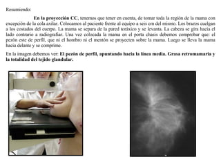 Resumiendo: En la proyección CC , tenemos que tener en cuenta, de tomar toda la región de la mama con excepción de la cola axilar. Colocamos al paciente frente al equipo a seis cm del mismo. Los brazos cuelgan a los costados del cuerpo. La mama se separa de la pared toráxico y se levanta. La cabeza se gira hacia el lado contrario a radiografiar. Una vez colocada la mama en el porta chasis debemos comprobar que: el pezón este de perfil, que ni el hombro ni el mentón se proyecten sobre la mama. Luego se lleva la mama hacia delante y se comprime. En la imagen debemos ver:  El pezón de perfil, apuntando hacia la línea media. Grasa retromamaria y la totalidad del tejido glandular. 