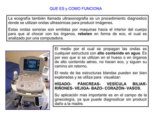 QUE ES y COMO FUNCIONA La ecografía también llamada ultrasonografia es un procedimiento diagnostico donde se utilizan ondas ultrasónicas para producir imágenes. Estas ondas sonoras son emitidas por maquinas hacia el interior del cuerpo para que al chocar con los órganos,  reboten  en forma de eco, el cual es analizado por una computadora. El medio por el cual se propagan las ondas es cualquier estructura con  alto contenido en agua . Es por eso que si se utilizan en el hueso o en órganos de alto contenido aéreo, no hacen eco, y siguen su camino sin retorno. El resto de las estructuras blandas pueden ser bien exploradas y se utiliza para  visualizar: HÍGADO- PÁNCREAS- VESÍCULA BILIAR- RIÑONES- VEJIGA- BAZO- CORAZÓN- VASOS. Su aplicación mas importante es en el campo de la ginecología, ya que puede diagnosticar sin producir daño a la madre. 